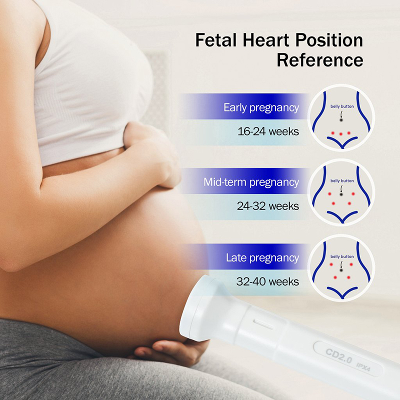 NatalTup Fetal Doppler Ultrasound Heartbeat Detector - Vysta Health