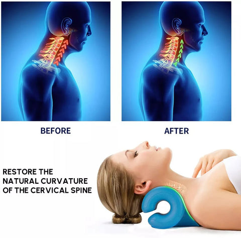 Chiropractic Neck Pillow  Cervical Posture Corrector