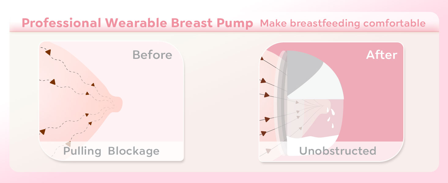 MomMed: The Effortless, Leak-proof and Wearable Breast Pump